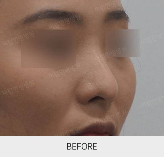 �Խñ� �����