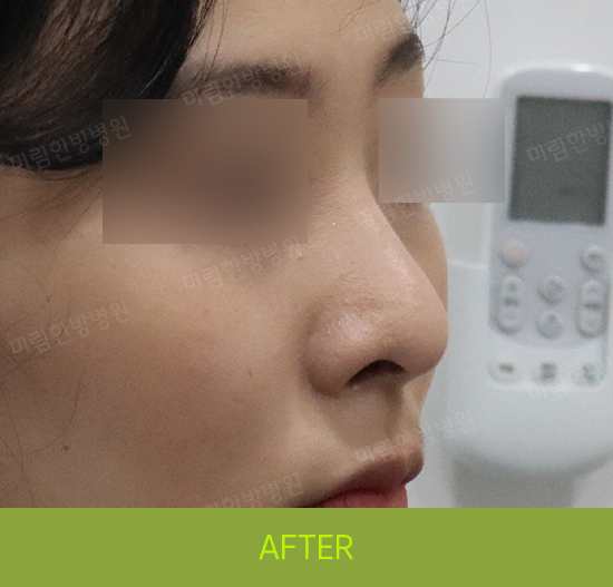 �Խñ� �����