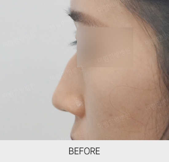 �Խñ� �����