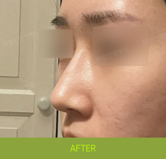 �Խñ� �����