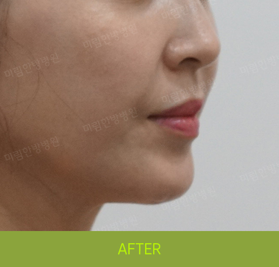 �Խñ� �����