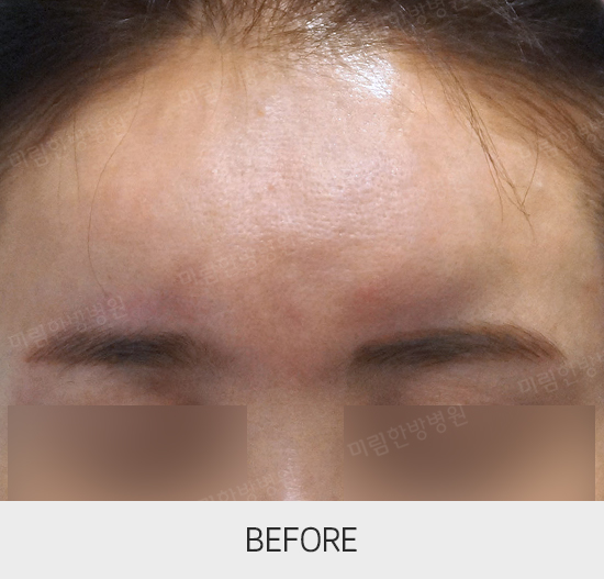 �Խñ� �����