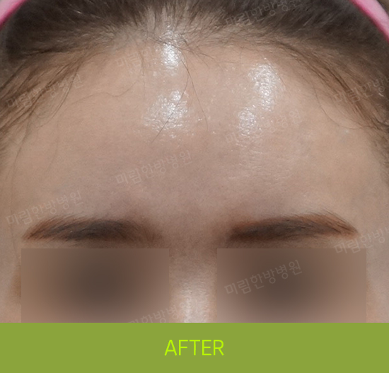 �Խñ� �����