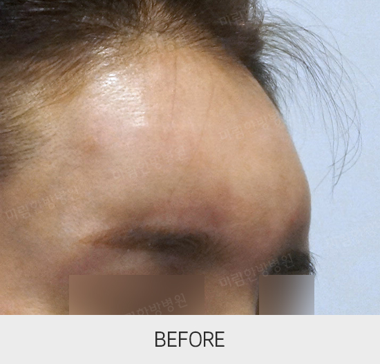 �Խñ� �����