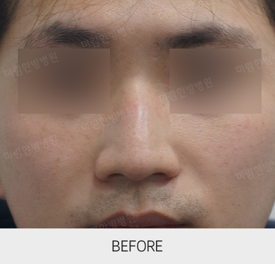 �Խñ� �����