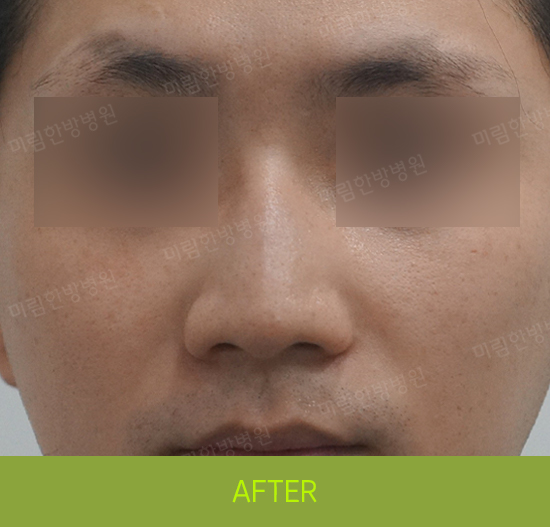 �Խñ� �����