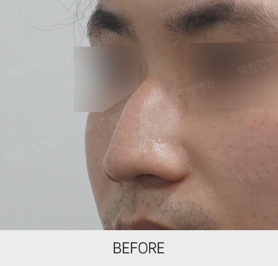 �Խñ� �����