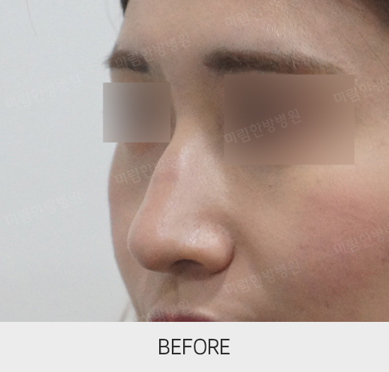 �Խñ� �����