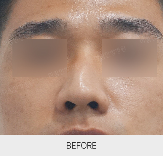 �Խñ� �����