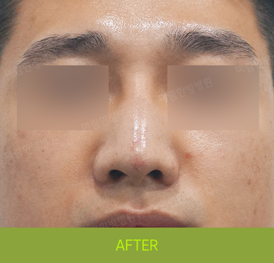 �Խñ� �����