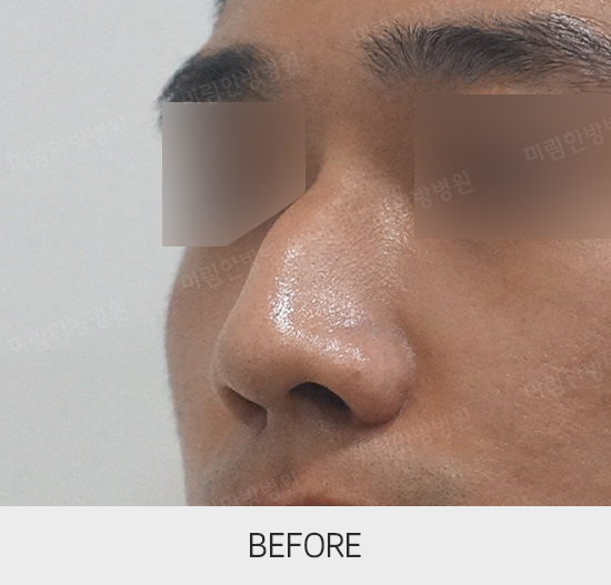 �Խñ� �����