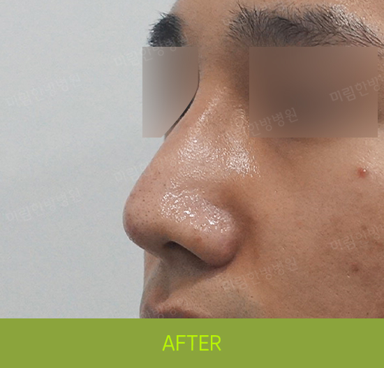 �Խñ� �����