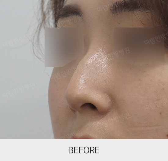 �Խñ� �����