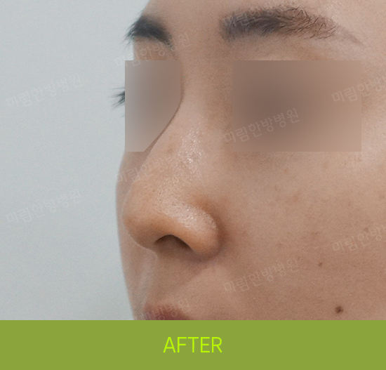 �Խñ� �����