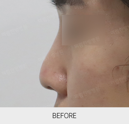 �Խñ� �����