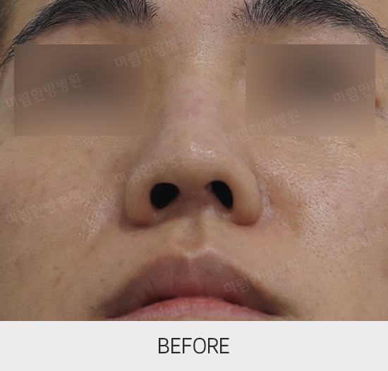 �Խñ� �����