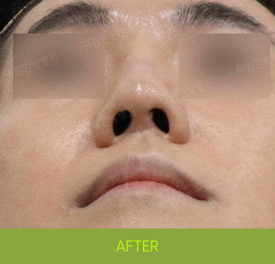 �Խñ� �����