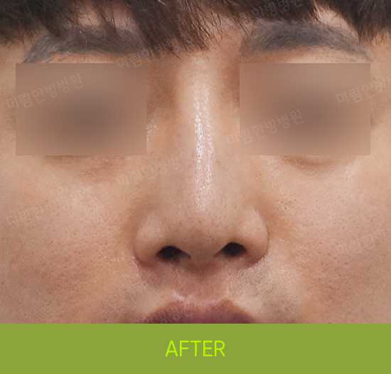 �Խñ� �����