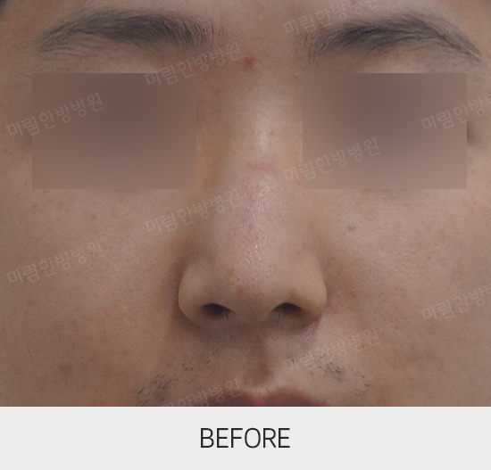 �Խñ� �����