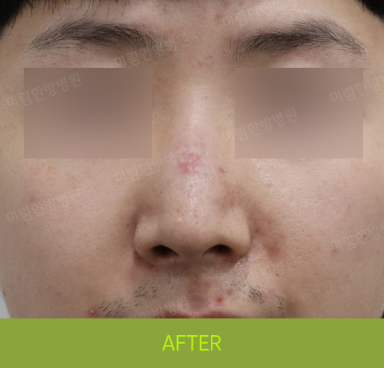 �Խñ� �����