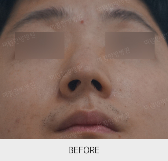 �Խñ� �����