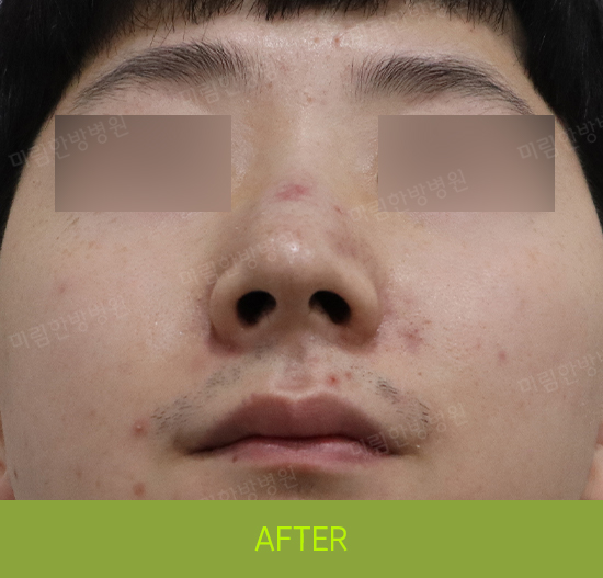 �Խñ� �����