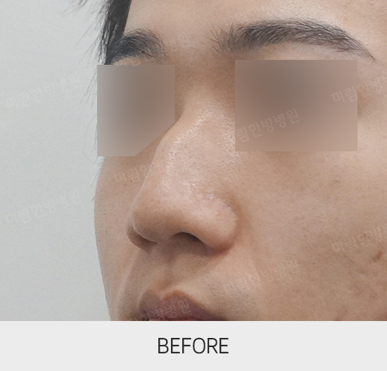 �Խñ� �����