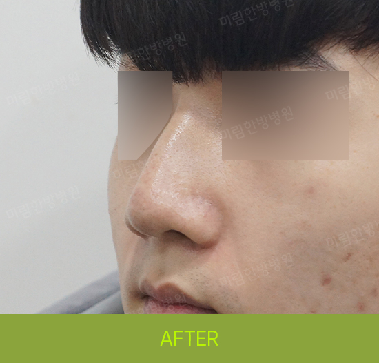 �Խñ� �����