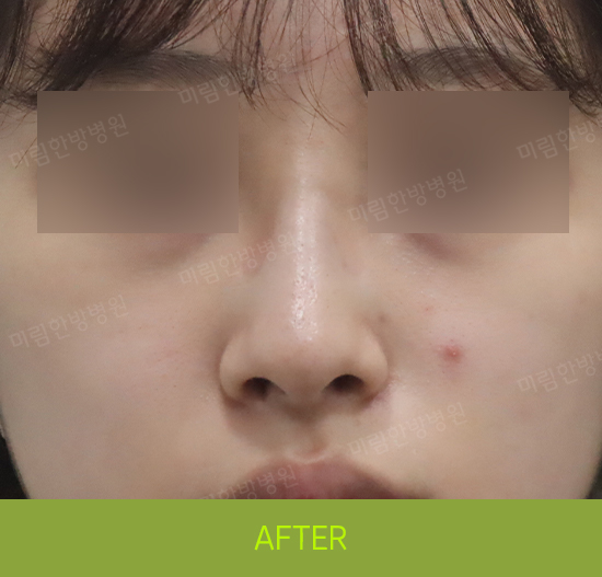 �Խñ� �����