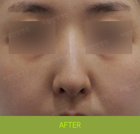 �Խñ� �����