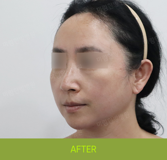 �Խñ� �����