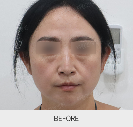 �Խñ� �����