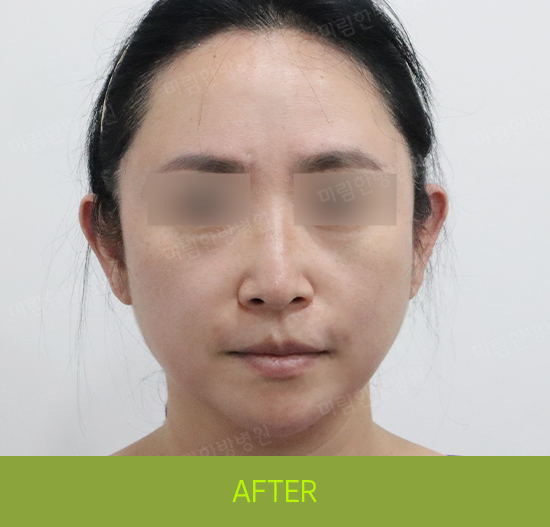 �Խñ� �����