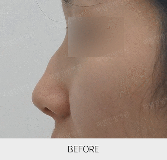 �Խñ� �����