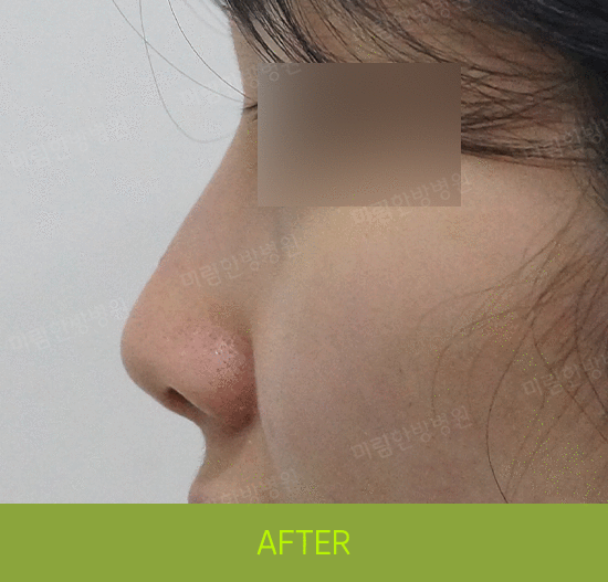 �Խñ� �����