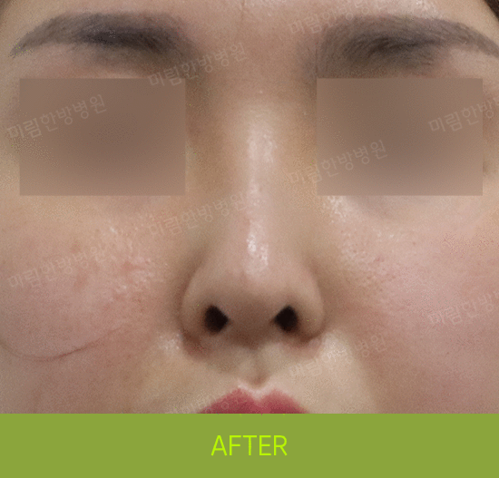 �Խñ� �����