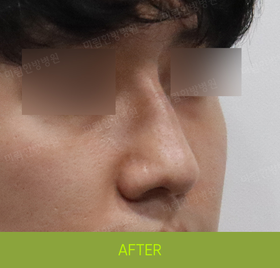 �Խñ� �����