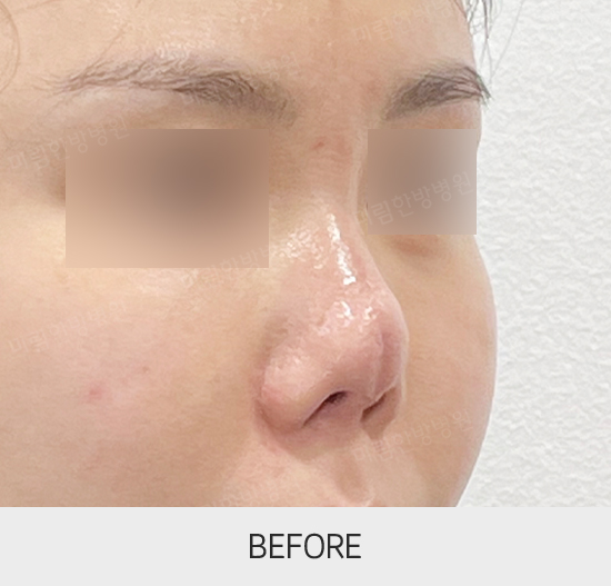 �Խñ� �����