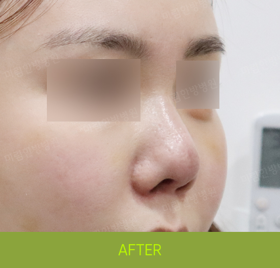 �Խñ� �����