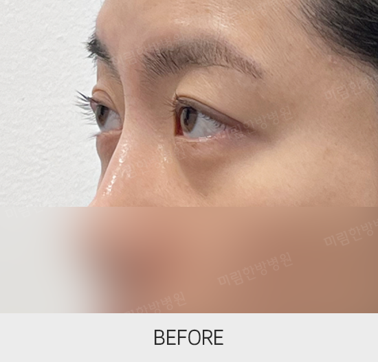 �Խñ� �����