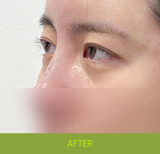 �Խñ� �����