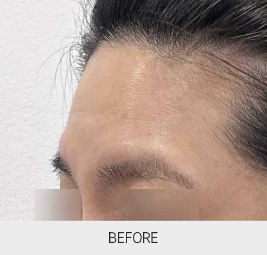 �Խñ� �����