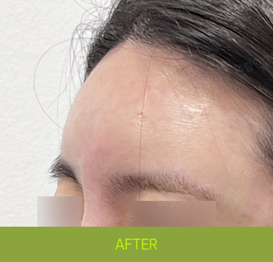 �Խñ� �����