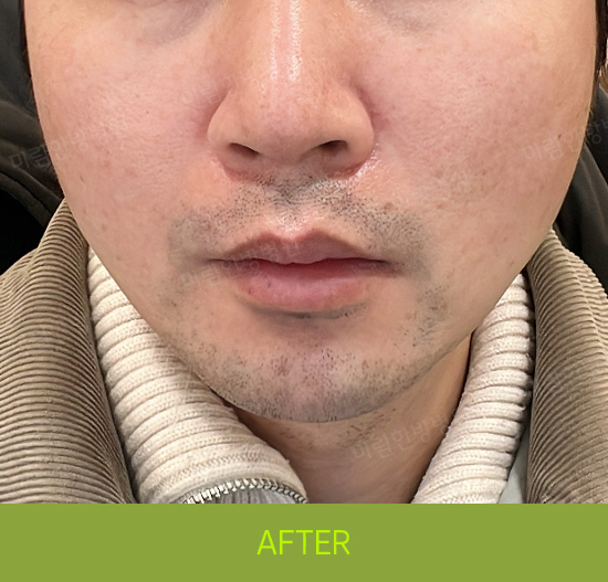 �Խñ� �����