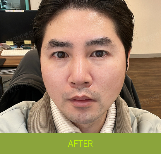 �Խñ� �����