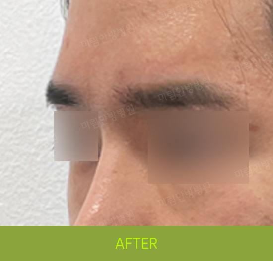 �Խñ� �����