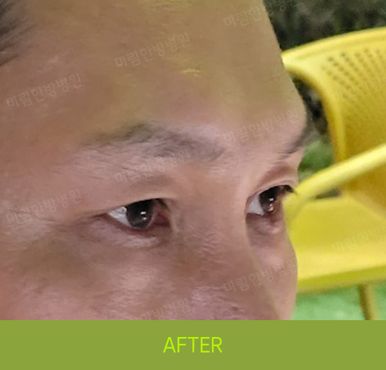 �Խñ� �����