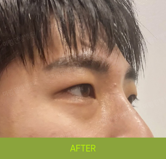 �Խñ� �����