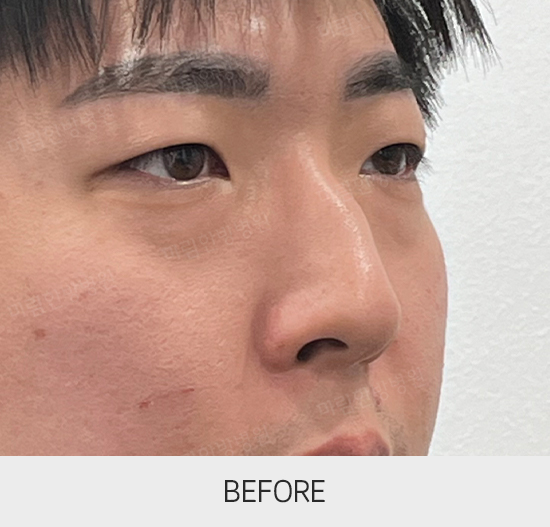 �Խñ� �����