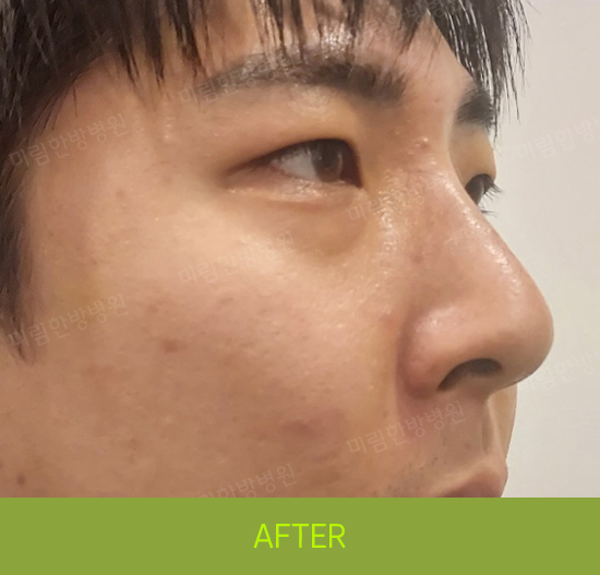 �Խñ� �����